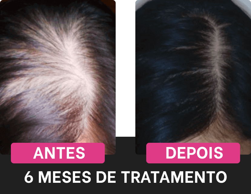 harmony-hair-original-resultado