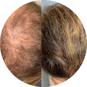 -harmony-hair