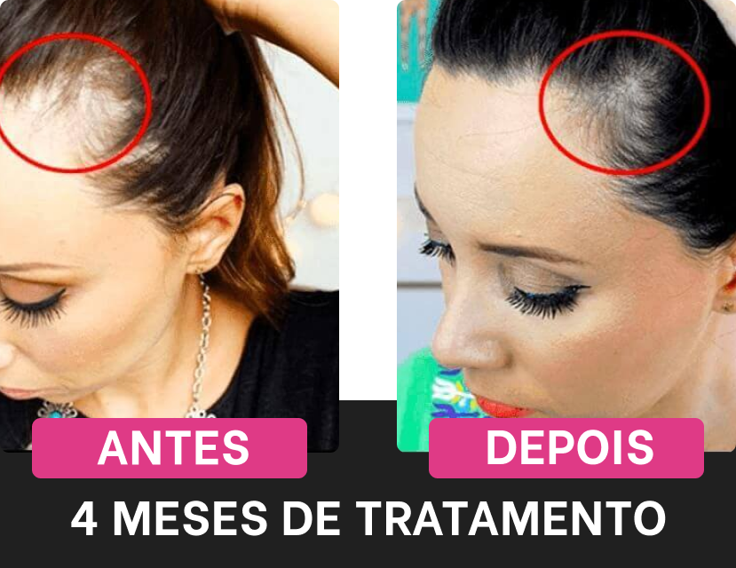 antes-depois-harmony-hair