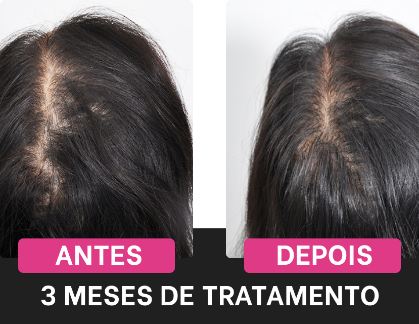 antes-depois-harmony-hair